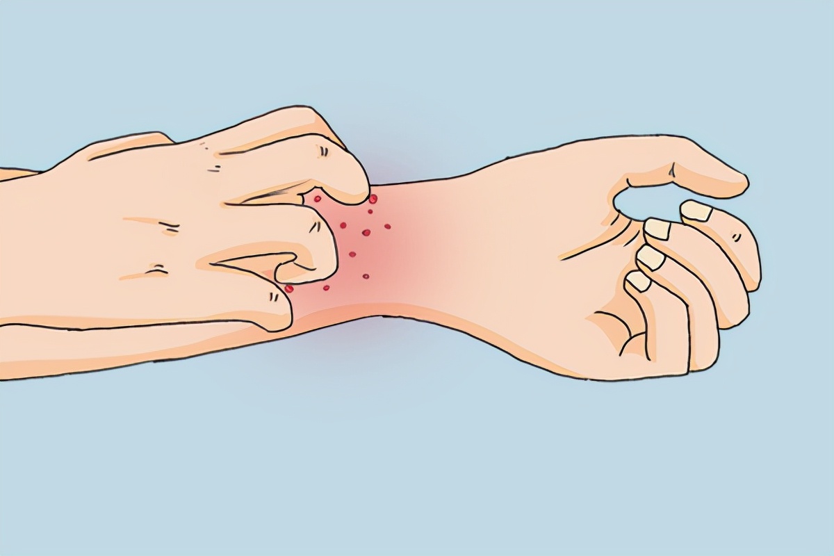 冬天皮肤变得干燥、瘙痒是怎么回事？记住这五点能帮你有效改善