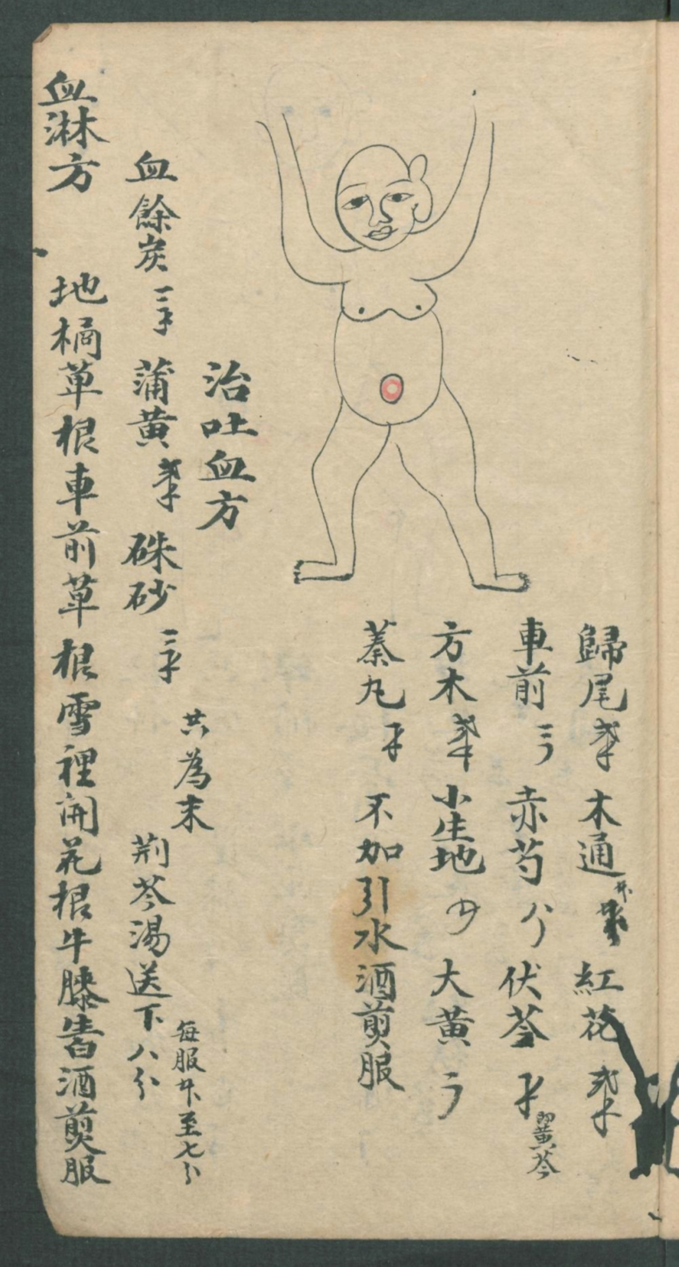 秘传跌打秘方,秘传跌打药方