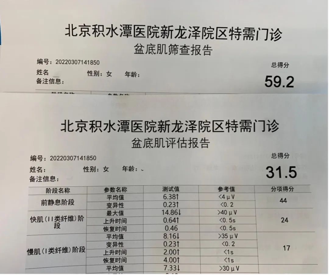 盆底康复训练效果,盆底康复治疗仪器哪个品牌的好