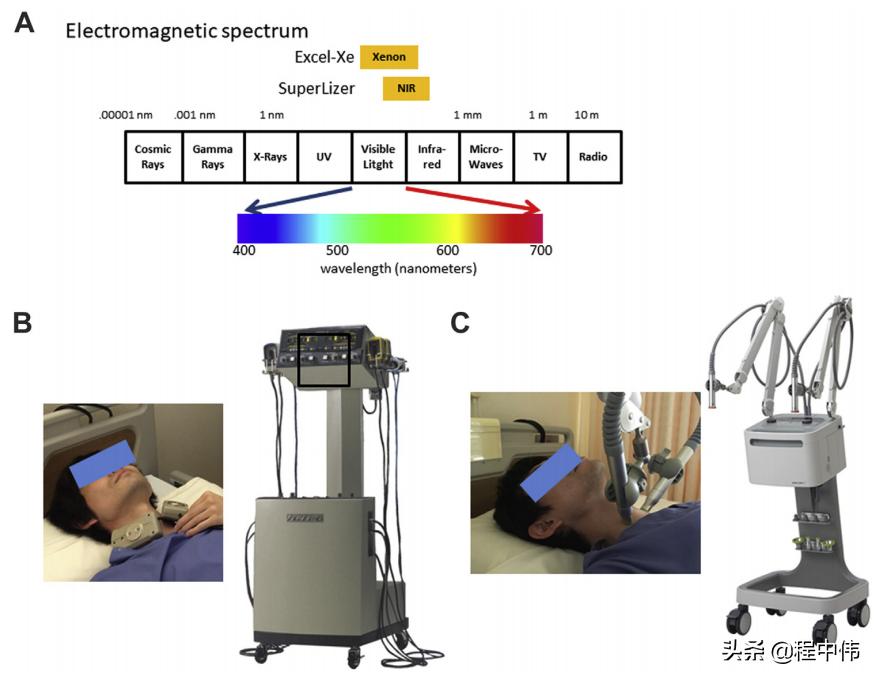 星状神经节阻滞治疗癫痫,星状神经节阻滞治疗心脏神经官能症