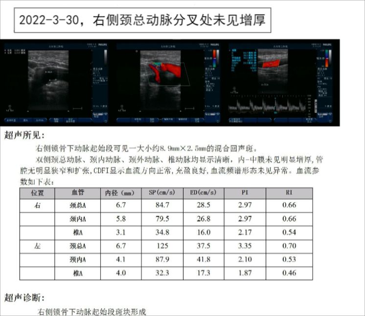 白塞病引起的葡萄膜炎看什么科,白塞病引起的葡萄膜炎治疗的偏方