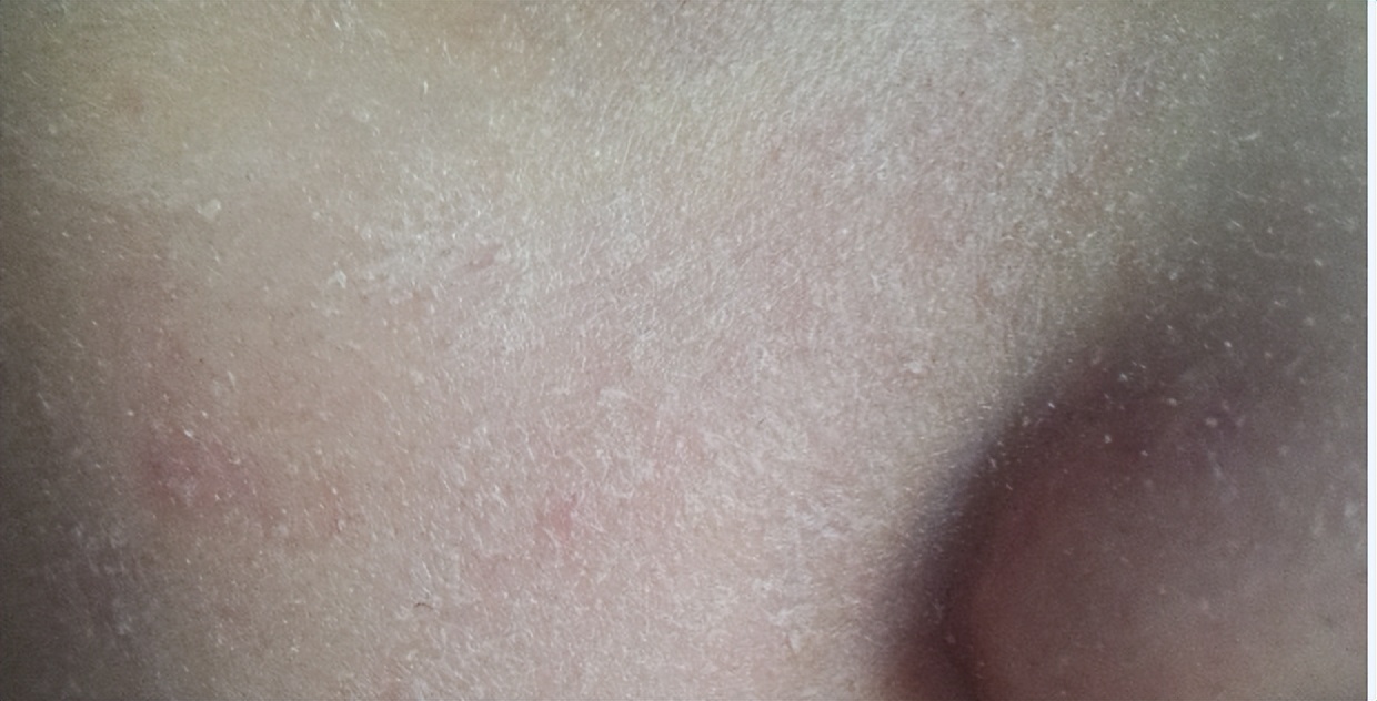 内行人推荐的护肤品,烂脸反复爆痘护肤品真实测评