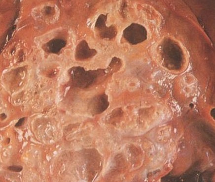 用于同时检测和基因分型细粒棘球蚴复合体的多重PCR方法