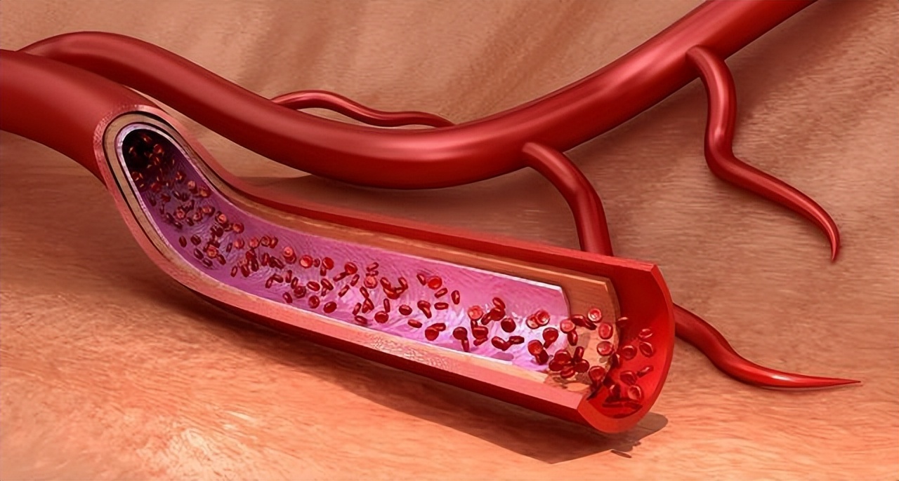 女人长期喝柠檬水对身体有好处吗,晚上喝蜂蜜柠檬水的好处与坏处