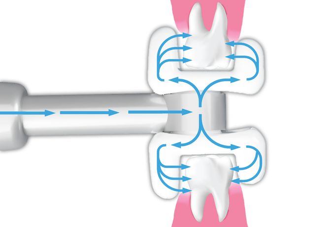 牙齿清洁神器冲牙器哪款好,改善口腔问题的牙膏牙刷