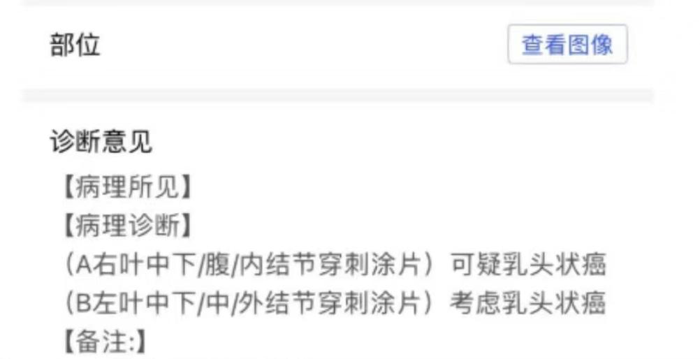 案例分享:36岁确诊甲状腺癌,从发现到治疗全过程