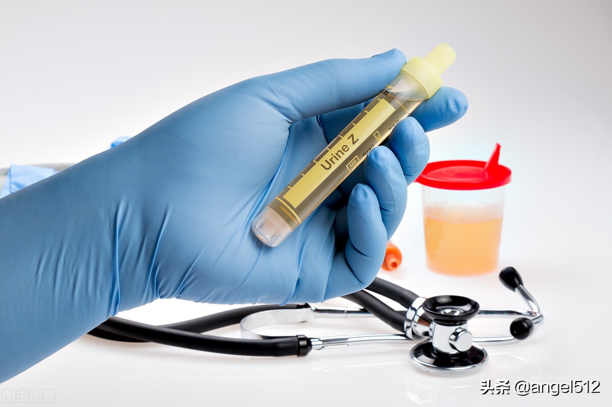 尿袋有沉淀物该怎么做,如何正确的将尿袋中的尿液排出