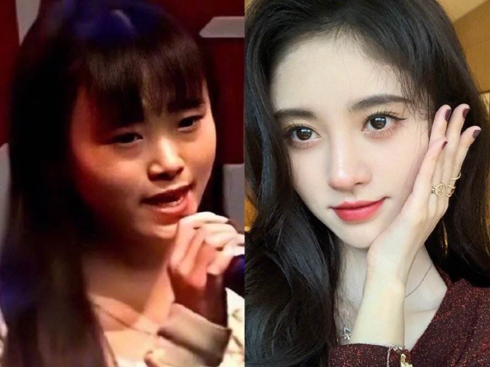 哪些明星整容后遗症越来越严重,整容明星后遗症对比图片