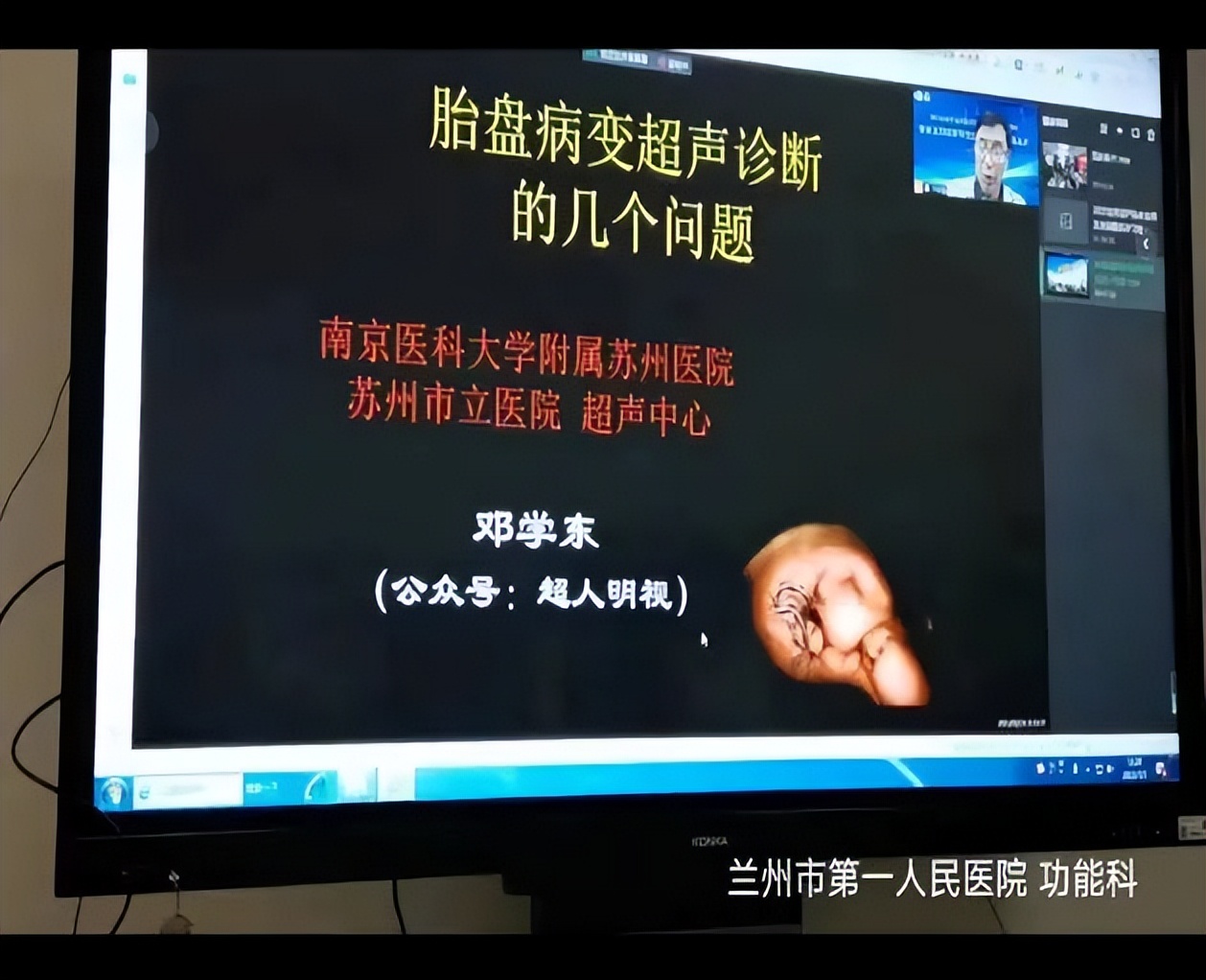 2023年盆底超声临床应用及进展精品培训班暨盆底功能障碍性疾病超声诊断精品班圆满落幕