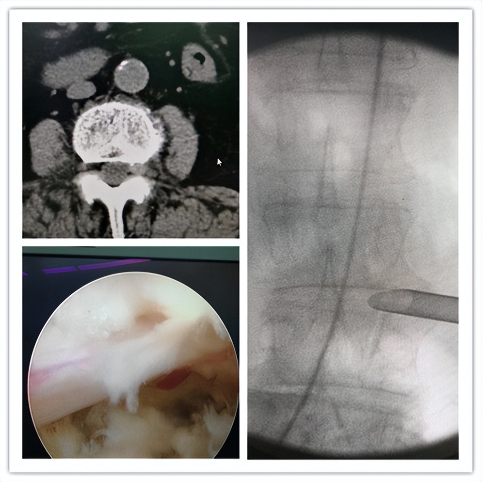 嘉善人民医院疼痛科专家,嘉善第一人民医院中医内科