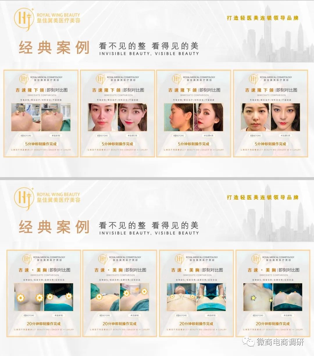 不开刀不手术零风险丰胸,不手术不开刀无痛丰胸