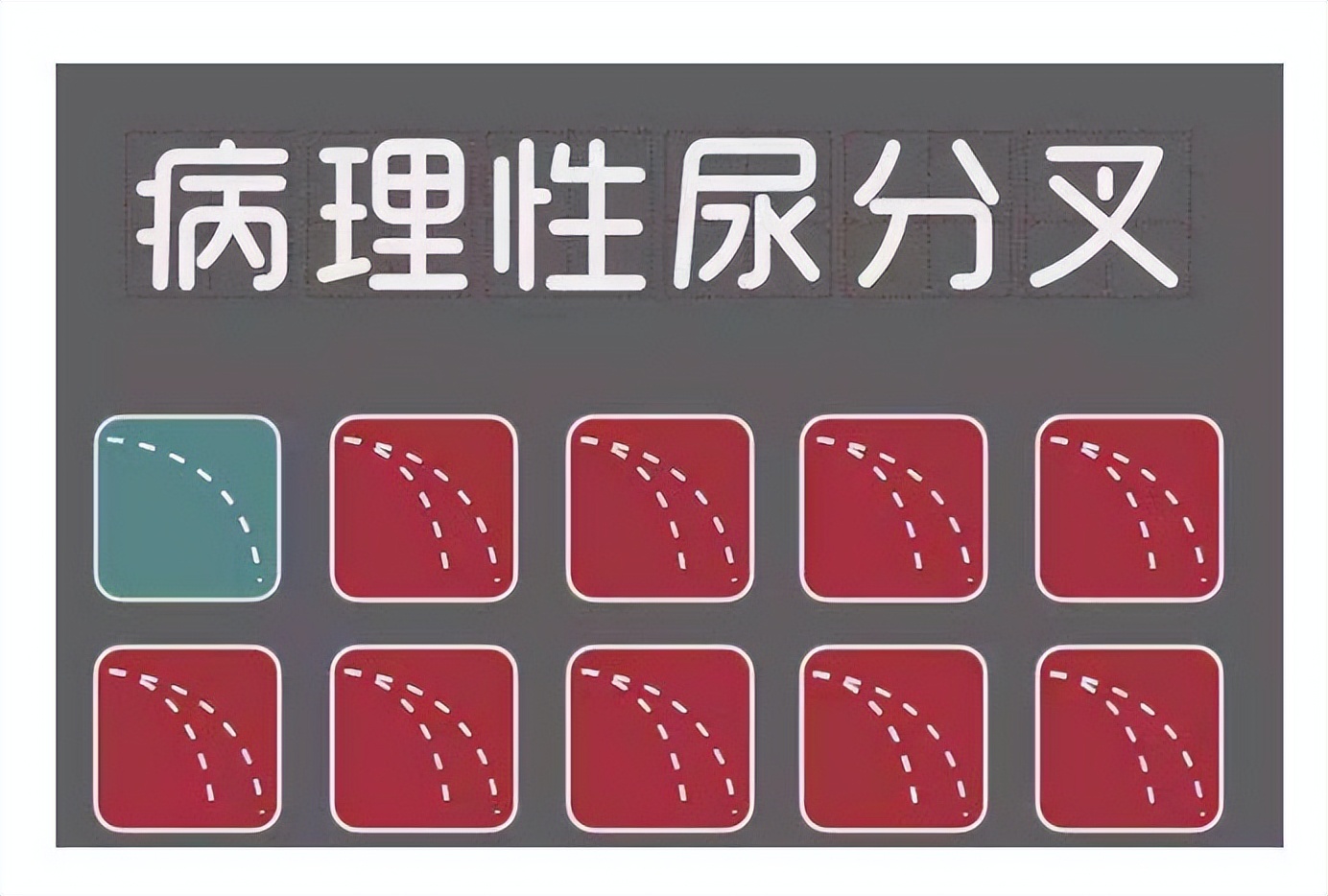 男性小便分叉是怎么回事,男性尿路粘连小便分叉