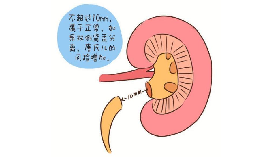 b超检查肾脏结晶怎么办,B超检查肾结晶与小结石怎么区分