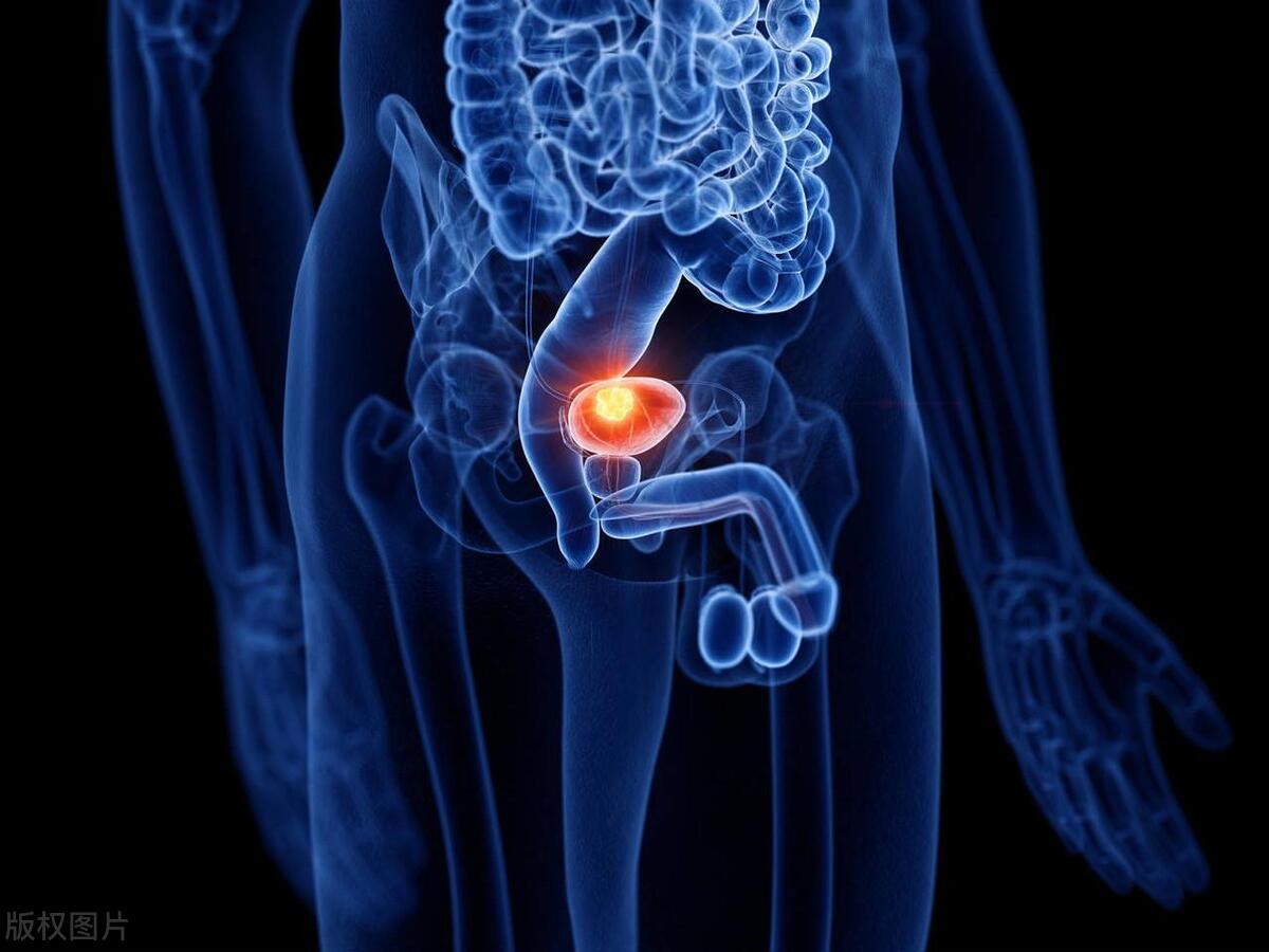 尿液混浊和米汤一样,尿液混浊和羊水有关吗