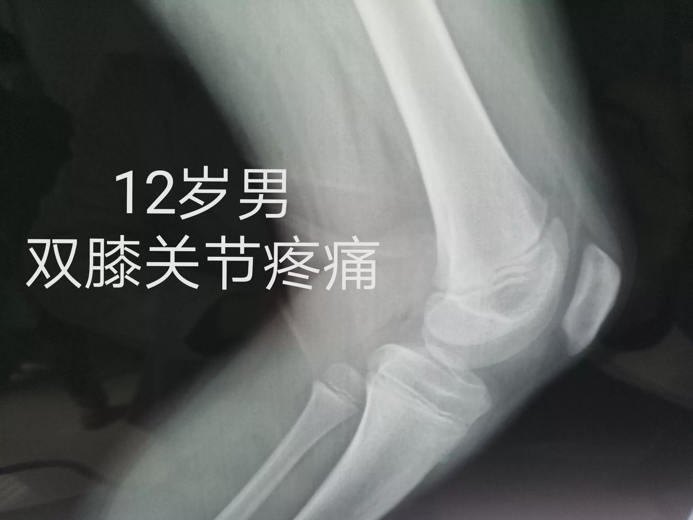 孩子膝盖疼和成长有关系吗,8岁孩子腿膝盖疼怎么回事