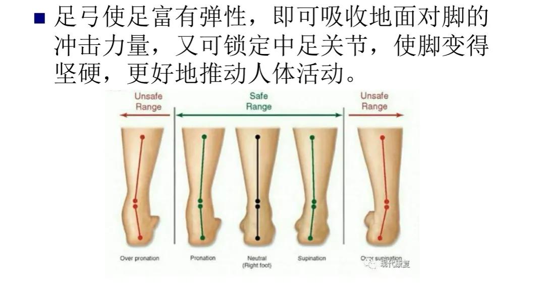 扁平足发病机制,扁平足诊断标准示意图