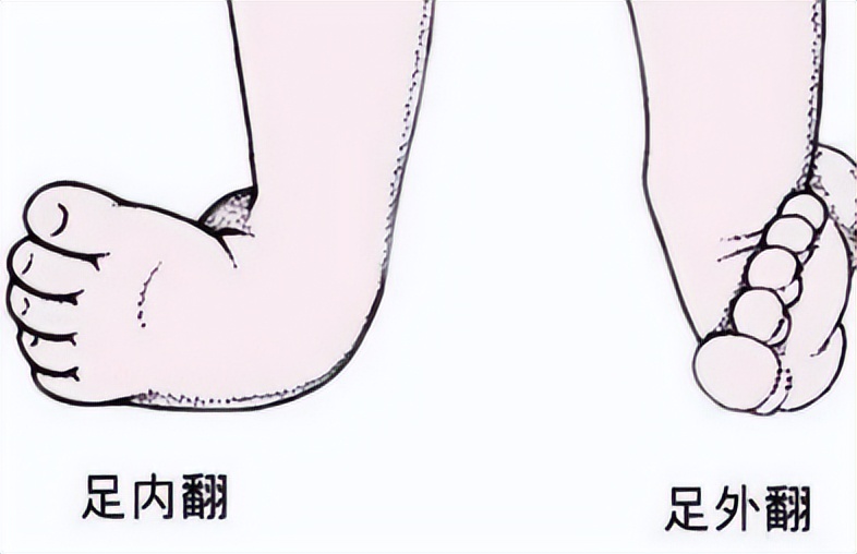 踝关节康复斜板站立训练方法,如何锻炼韧带保证踝关节稳定性