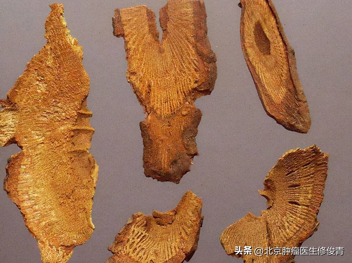 中医治乳腺癌医案,乳腺癌能吃软坚散结的药吗