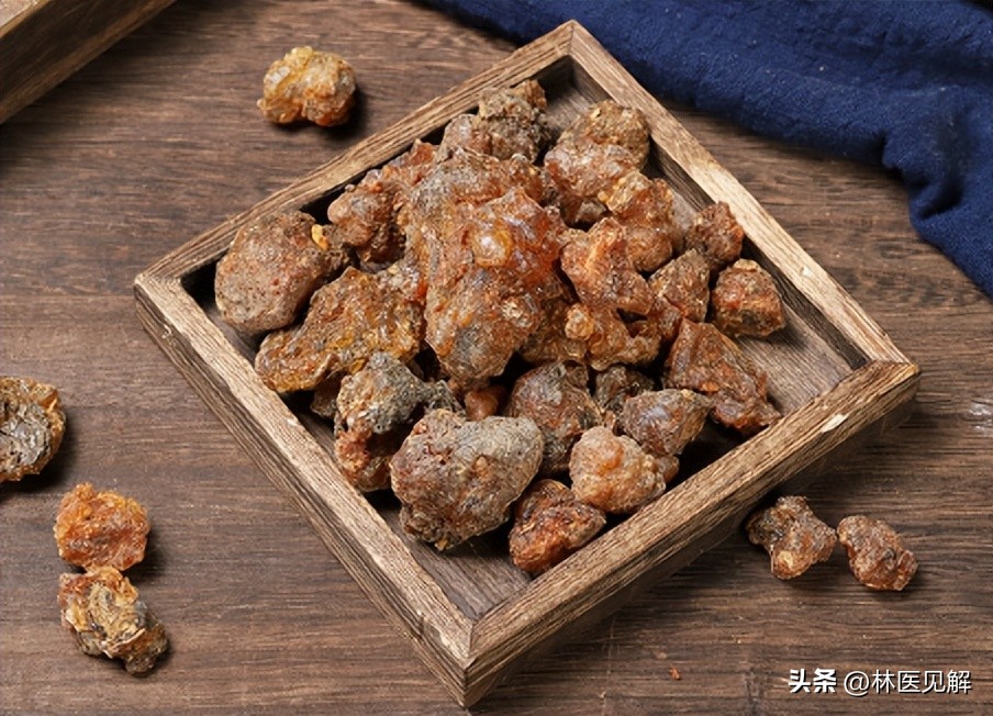 得了前列腺炎表现只有尿频尿急,前列腺炎小便困难怎么回事