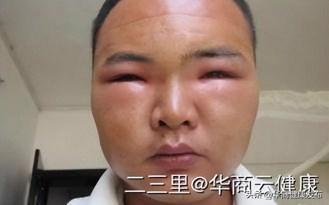 实用知识：赏花被蜂追，摆啥姿势安全？