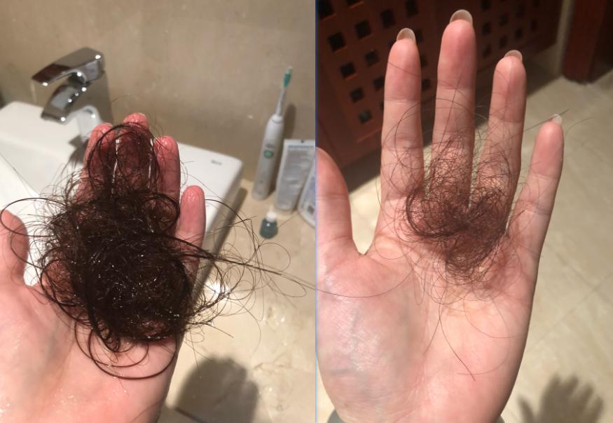 有效的防掉防脱洗发水,什么防脱洗发水适合干性头发用