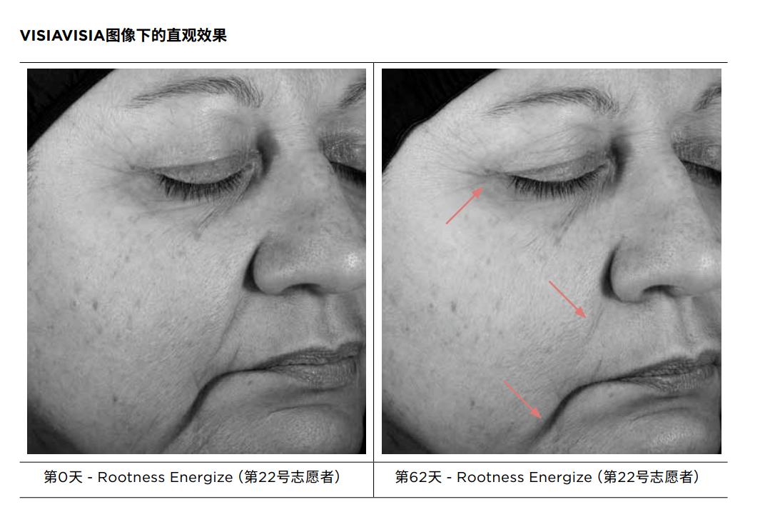 最贵的一瓶护肤品,很昂贵的护肤品