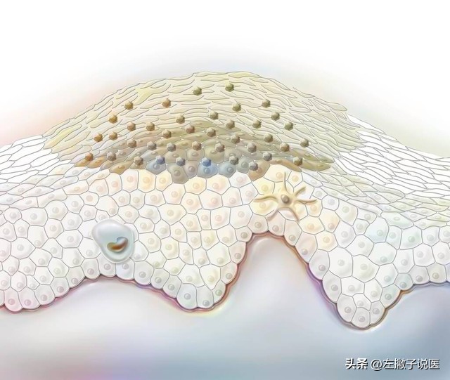 脖子上的“小肉球”是怎么一回事？可以用手抠掉吗？告诉你答案