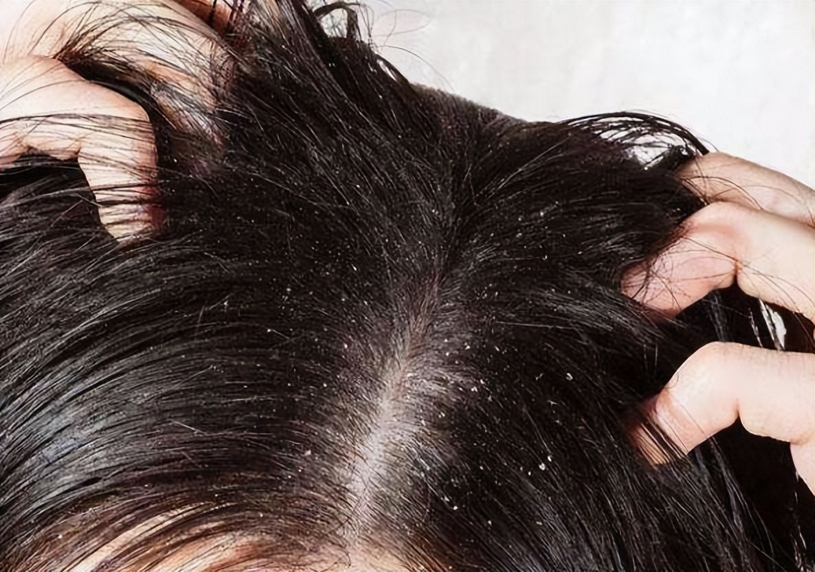 2023阿道夫洗发水真实测评,洗发水排行榜第一名阿道夫