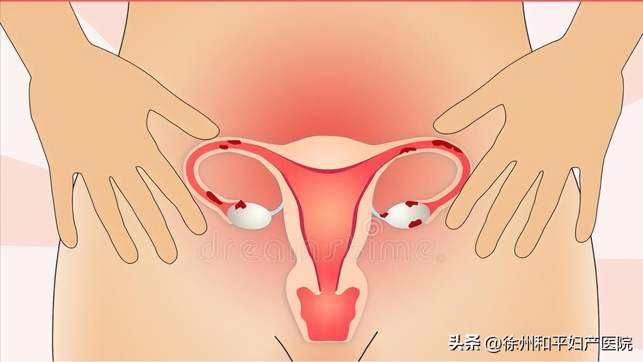 恶露反复停了又来大姨妈,产后恶露快完了突然又开始出血