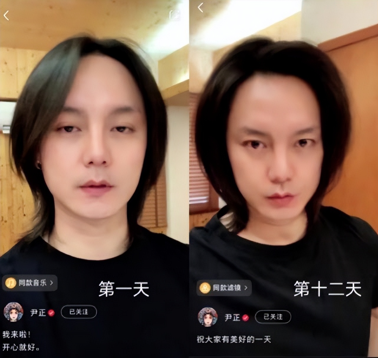 瘦到脸部凹陷到底好不好看,瘦到五官凹陷