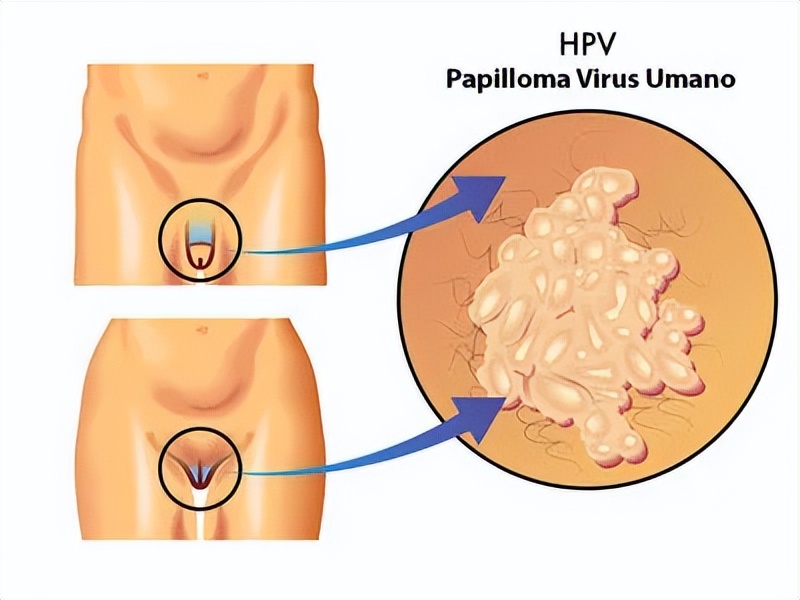 秘密花园激光,秘密花园特效药
