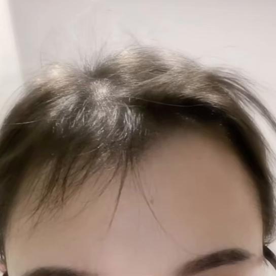 姜与生姜洗发水真的防脱发吗,真的有效的生姜洗发水