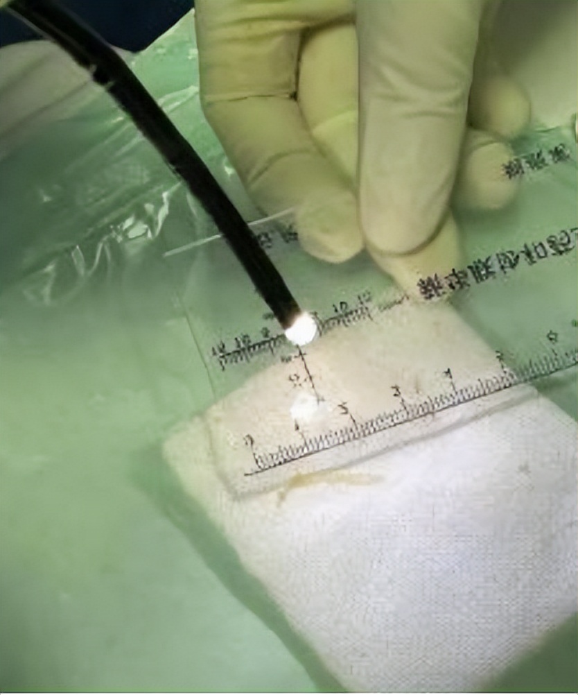 小孩咳嗽发烧前面高热后面低热,孩子反复高热咳嗽是什么原因