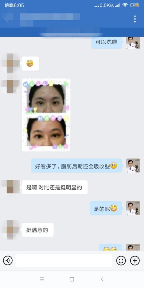 整形双眼皮失败案例,广州宝妈产后修复
