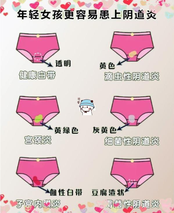 女生内裤上有什么健康信号,内裤有炎症的表现