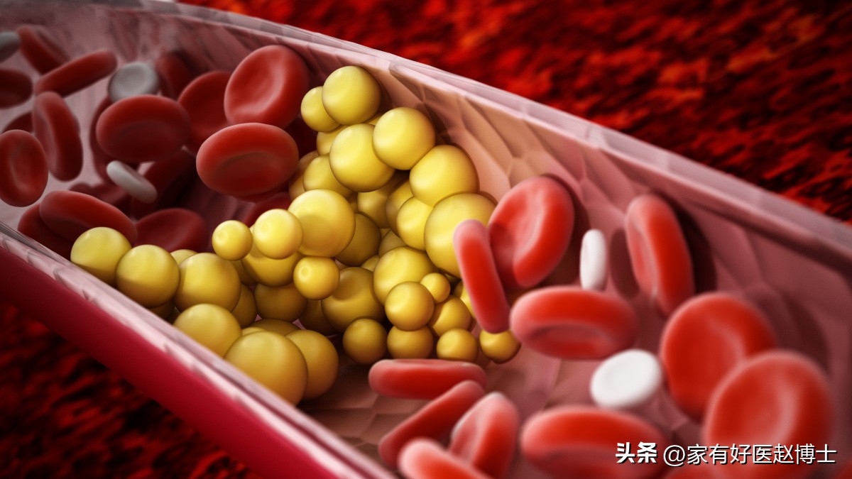 颈动脉没有斑块可以停用他汀吗,一般他汀吃多久颈动脉斑块有效果