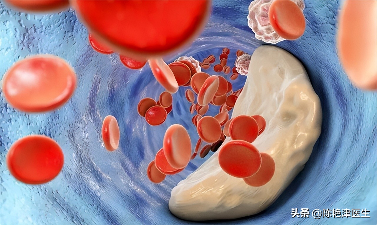 心梗前6个小时能查出什么病,心梗发作前5个部位最先发出警报