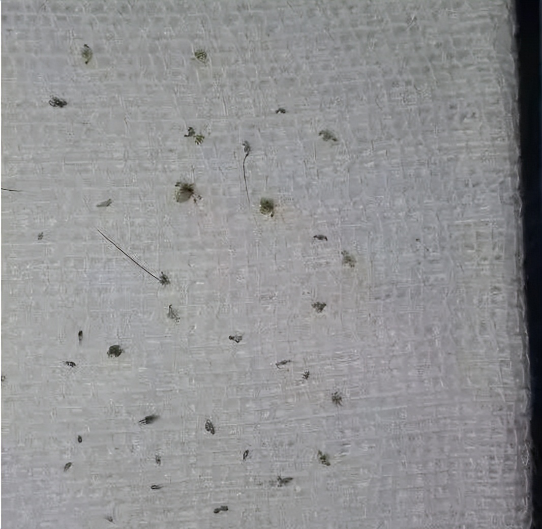 男子腹部痒,男性大量阴虱和虫卵