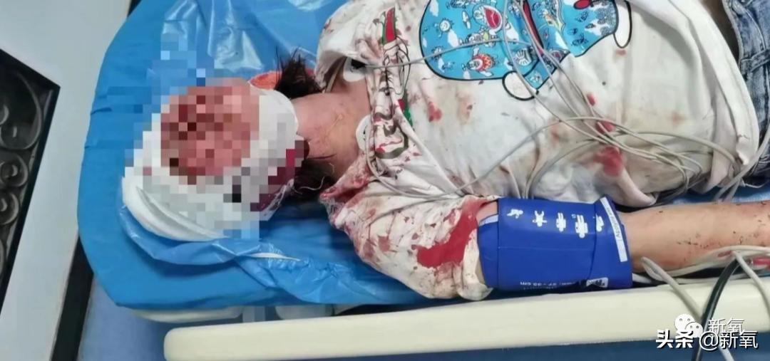 唐山女孩儿被打的状况现在怎么样,最新唐山女孩被打是什么原因