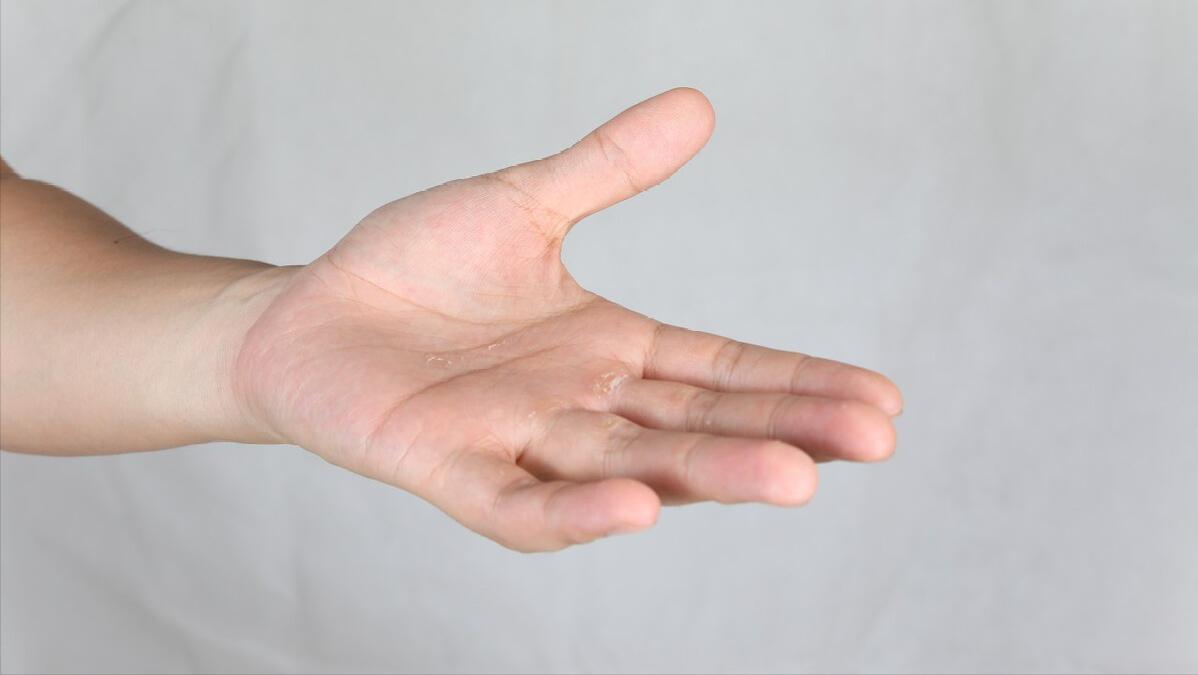 小孩手脚脱皮缺什么维生素,孩子手脚脱皮是缺什么维生素