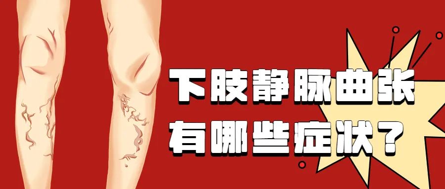 跷二郎腿静脉曲张怎么治,静脉曲张跷二郎腿有好处吗