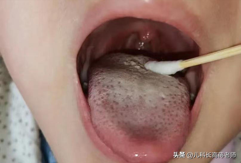 孩子不长个也不长肉怎么治疗呢,孩子不长个也不长肉中医怎么调理