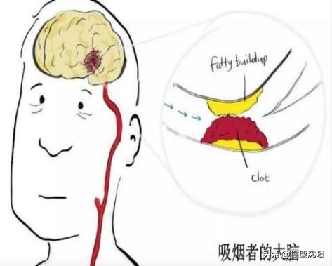 世界无烟日吸烟对身体的十大危害,世界无烟日烟的危害不容小视