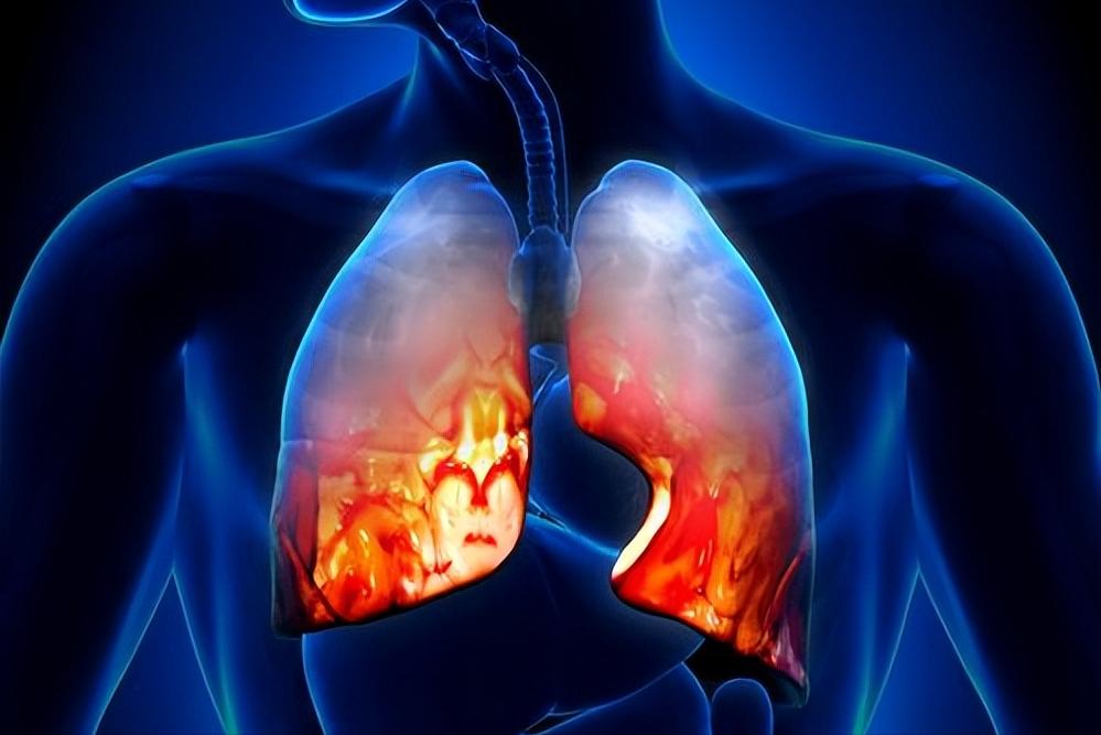 中医“汗法”可用于治疗哪些皮肤疾病？有什么注意事项和禁忌？