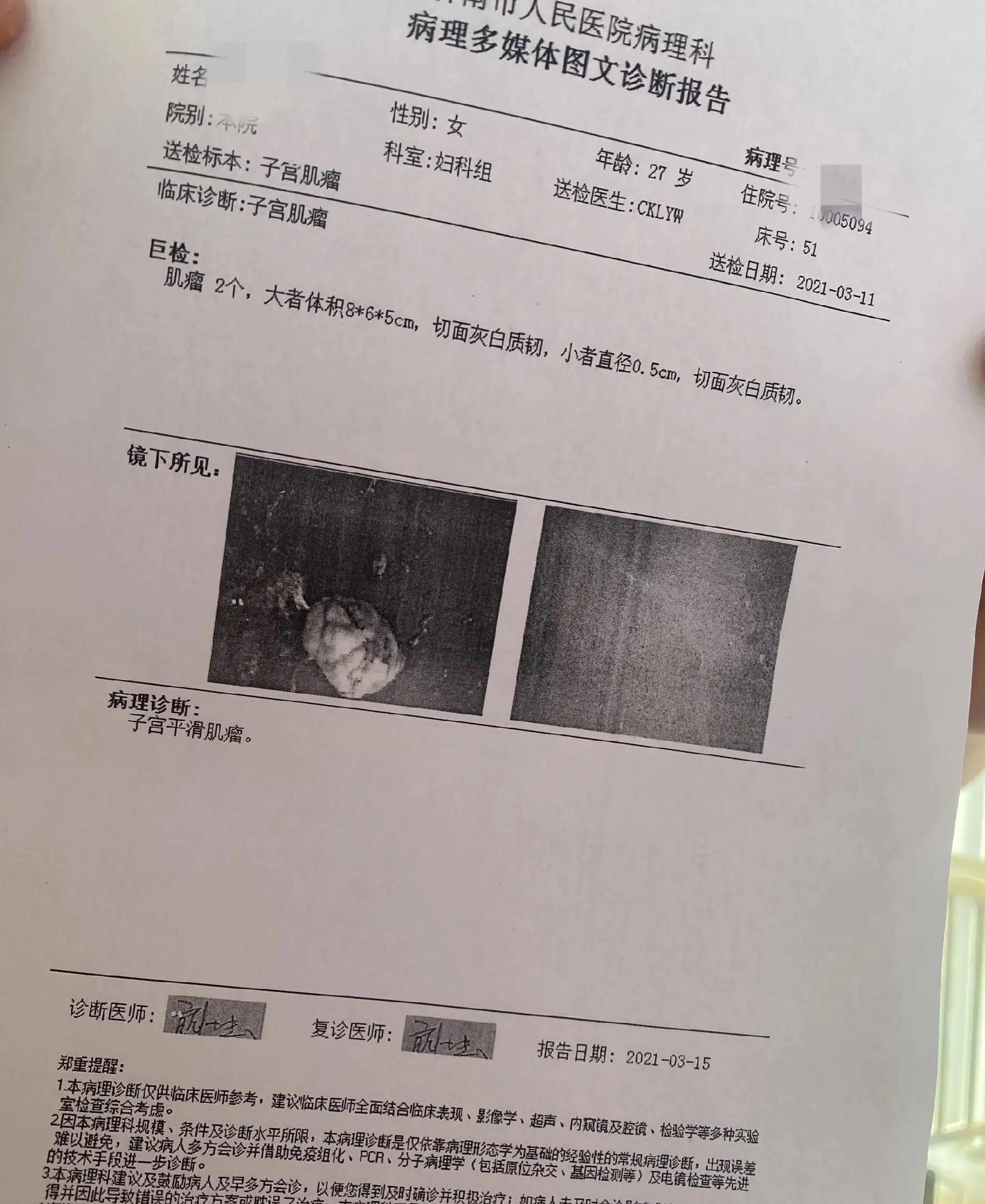 子宫肌瘤消融手术费用价格表,子宫肌瘤手术费用大约多少钱