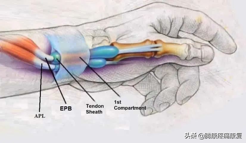 前臂疼痛，这五个动作就能缓解