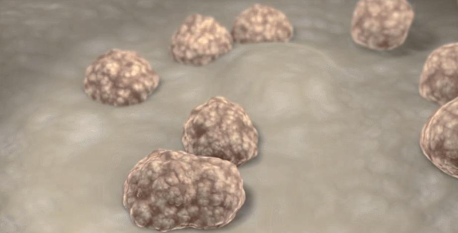 car-t细胞免疫疗法治愈后会复发吗,car-t细胞免疫疗法是哪家公司的