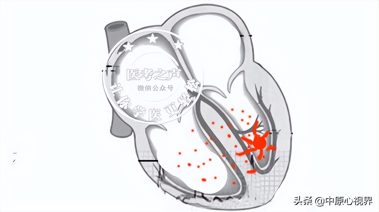 护考几种常见的心电图,常见的心电图图形分析