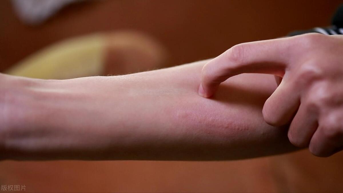 护肤达人推荐祛痘,护肤十大必备药膏