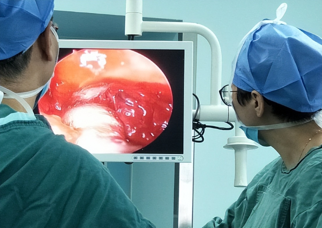 分泌性中耳炎是什么，为什么儿童得病几率更大，要怎么治疗